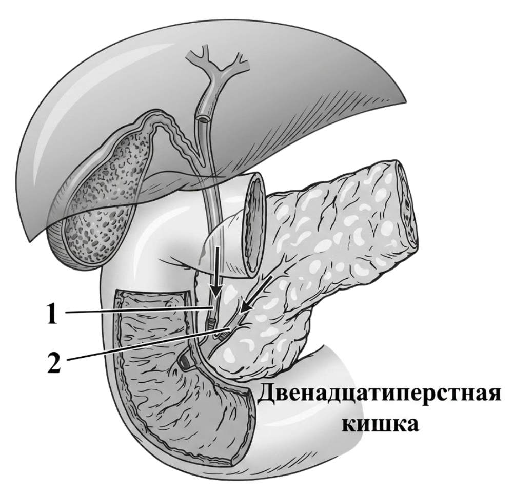 Иллюстрация к заданию, рис.1