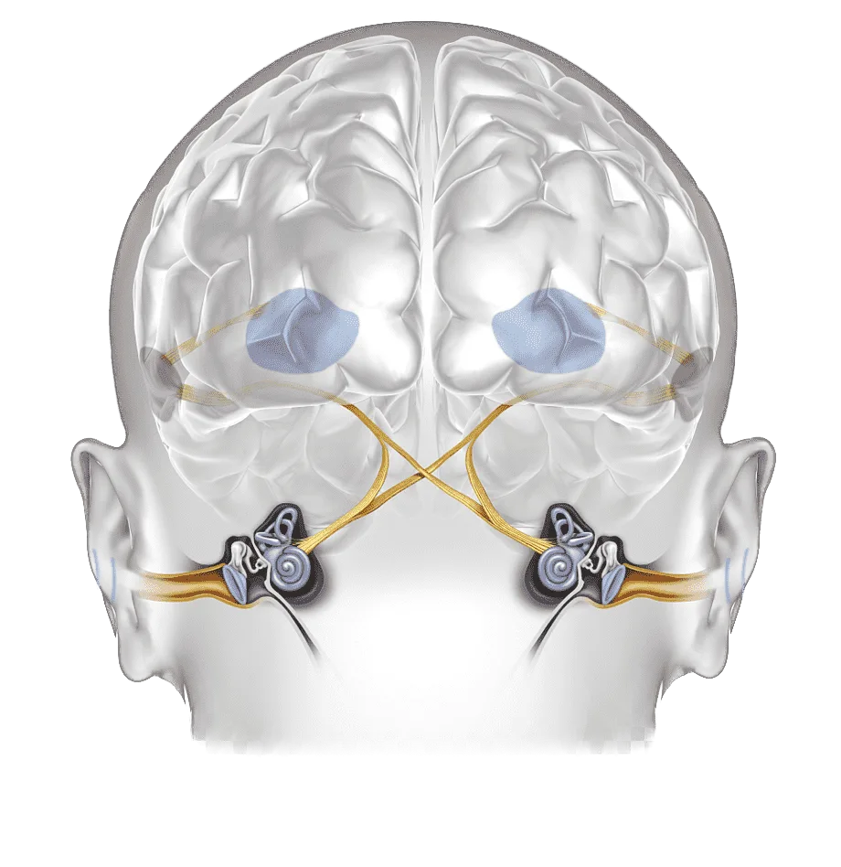Что такое "мозговой слух"