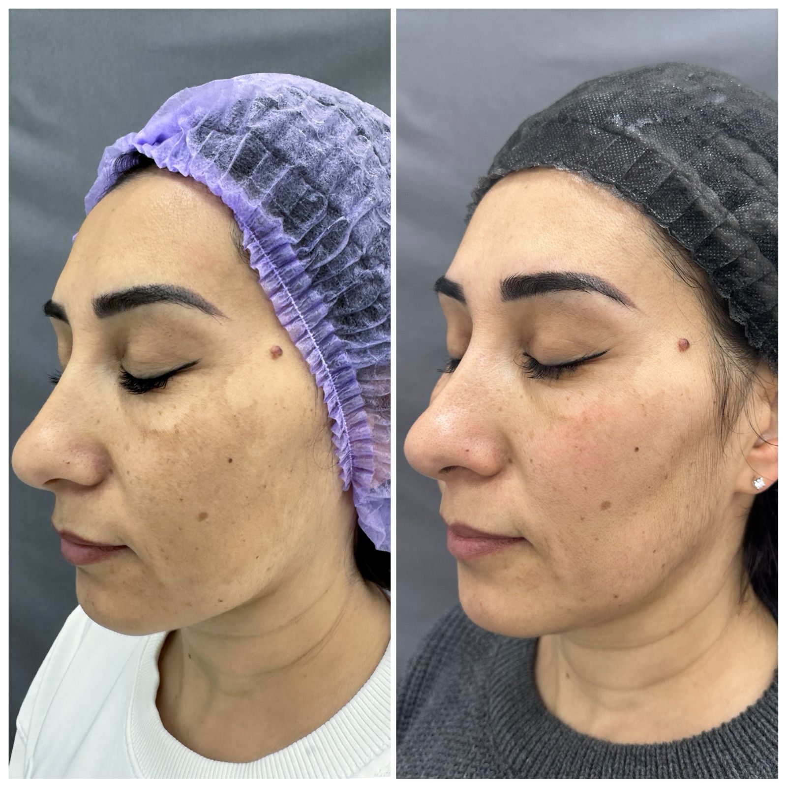 Результаты до и после