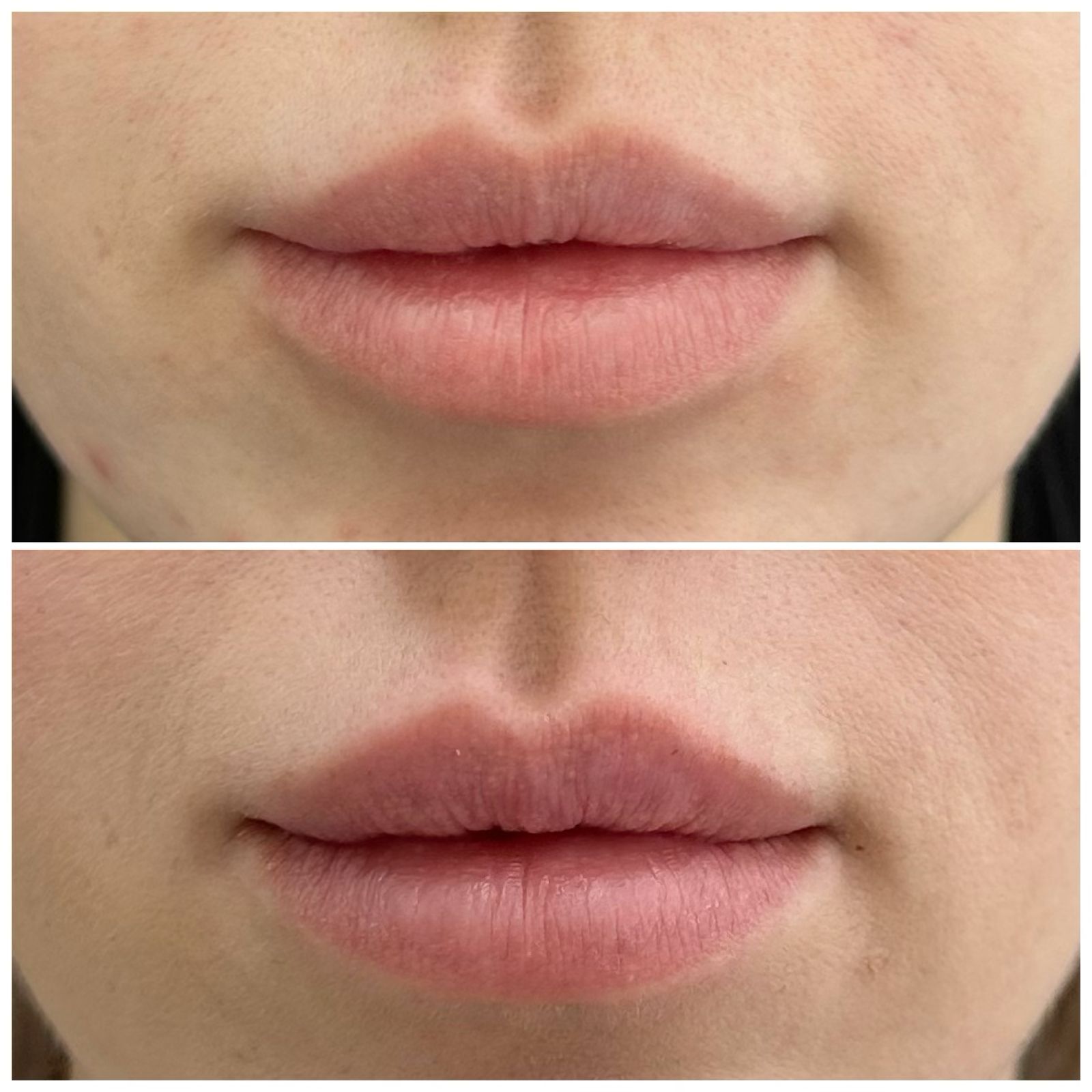 Результаты до и после