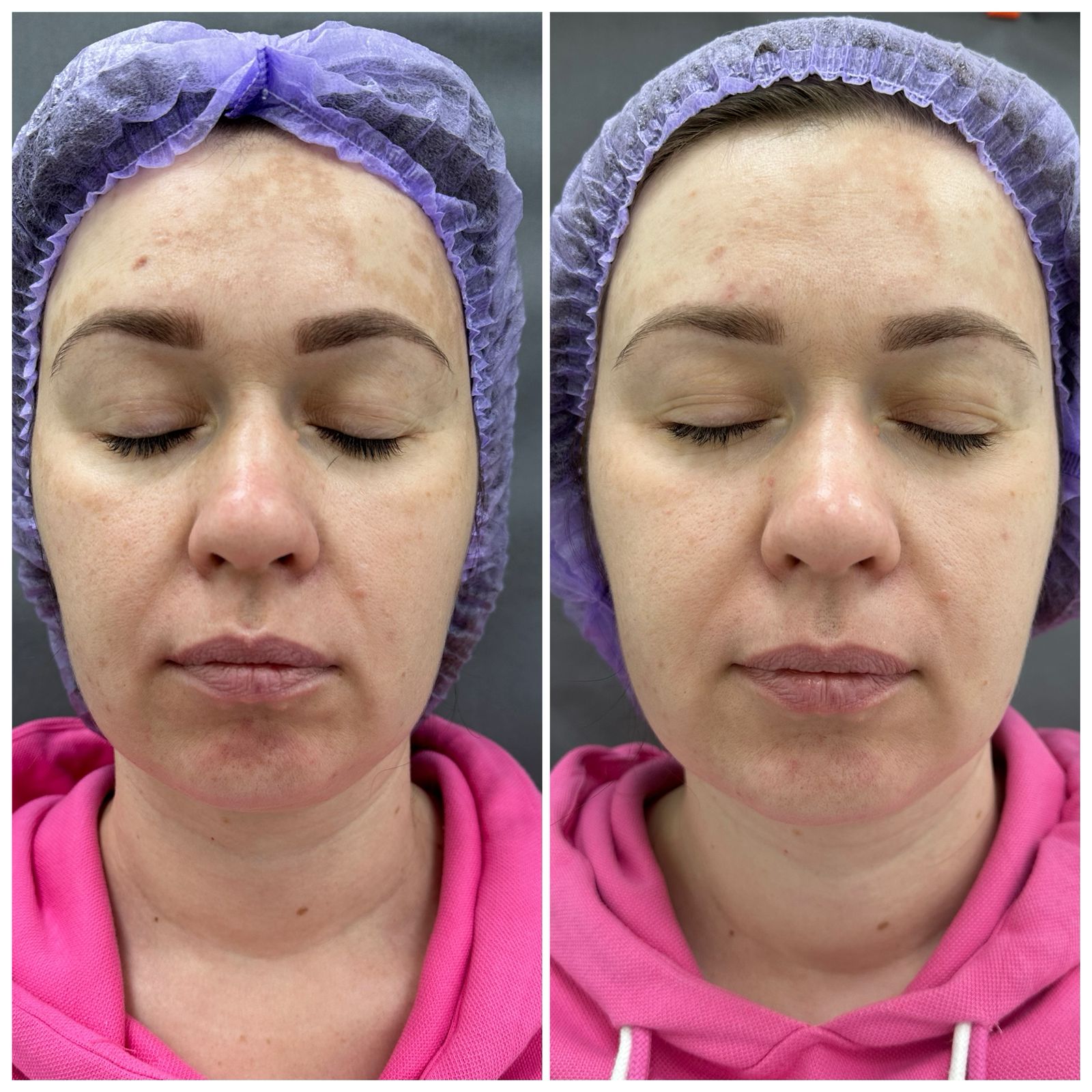 Результаты до и после