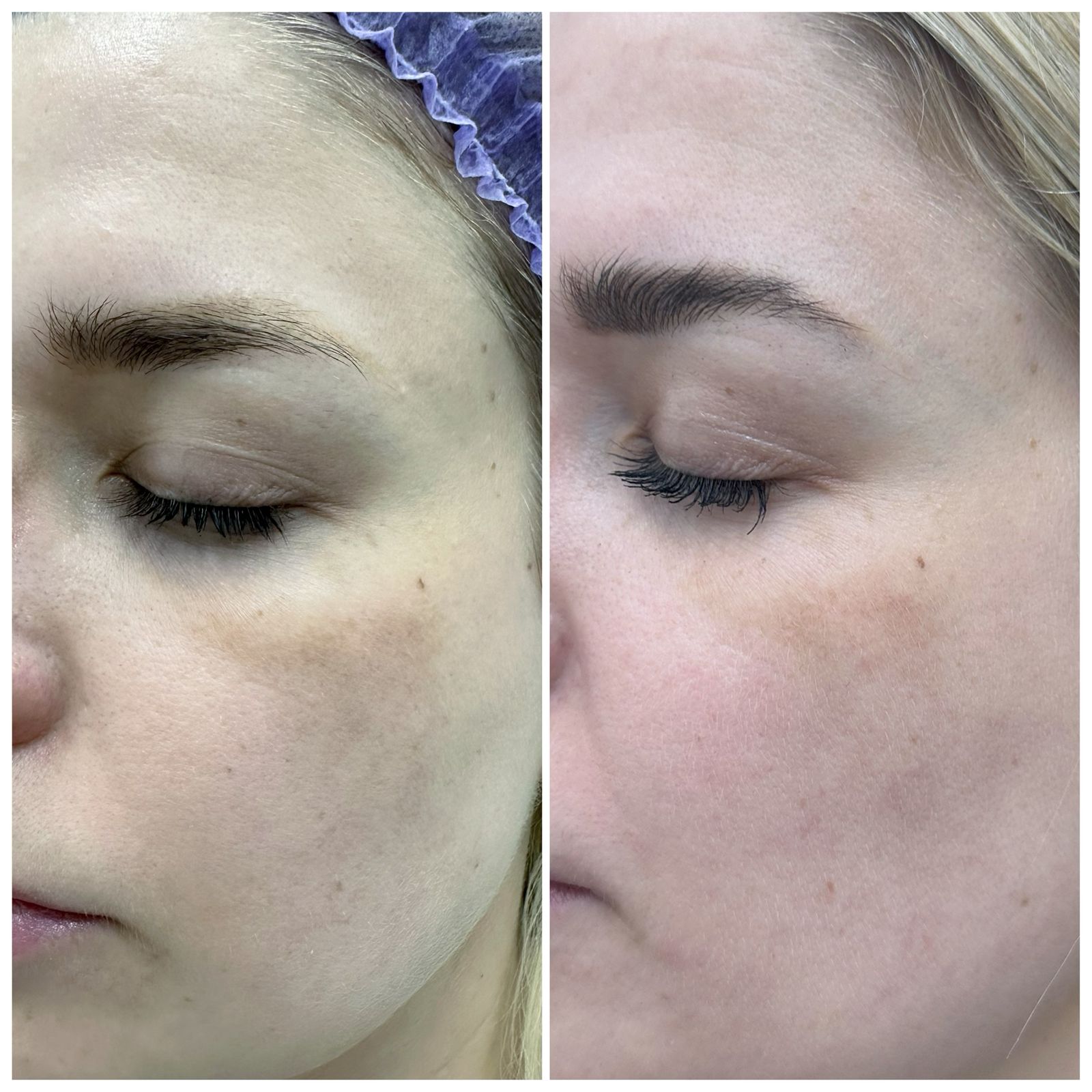 Результаты до и после