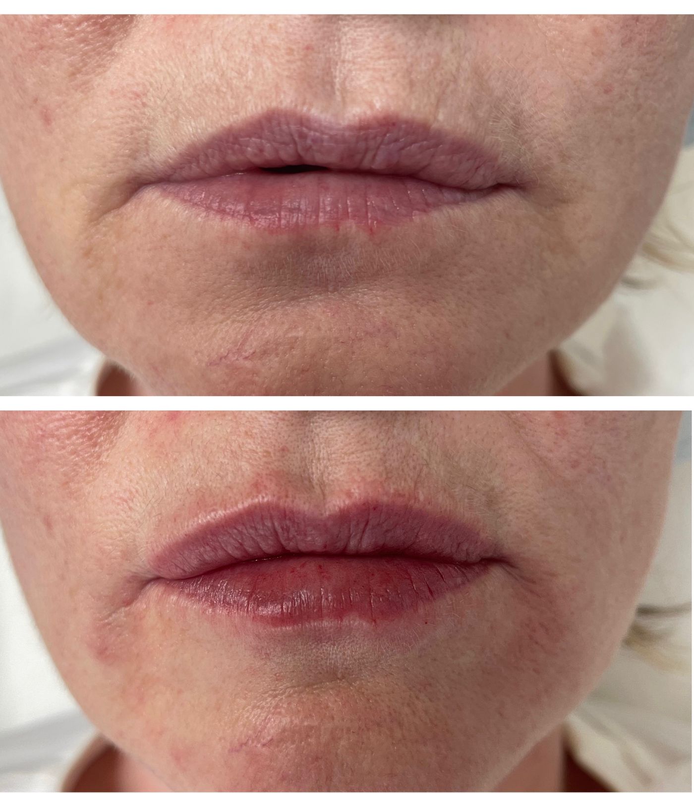 Результаты до и после