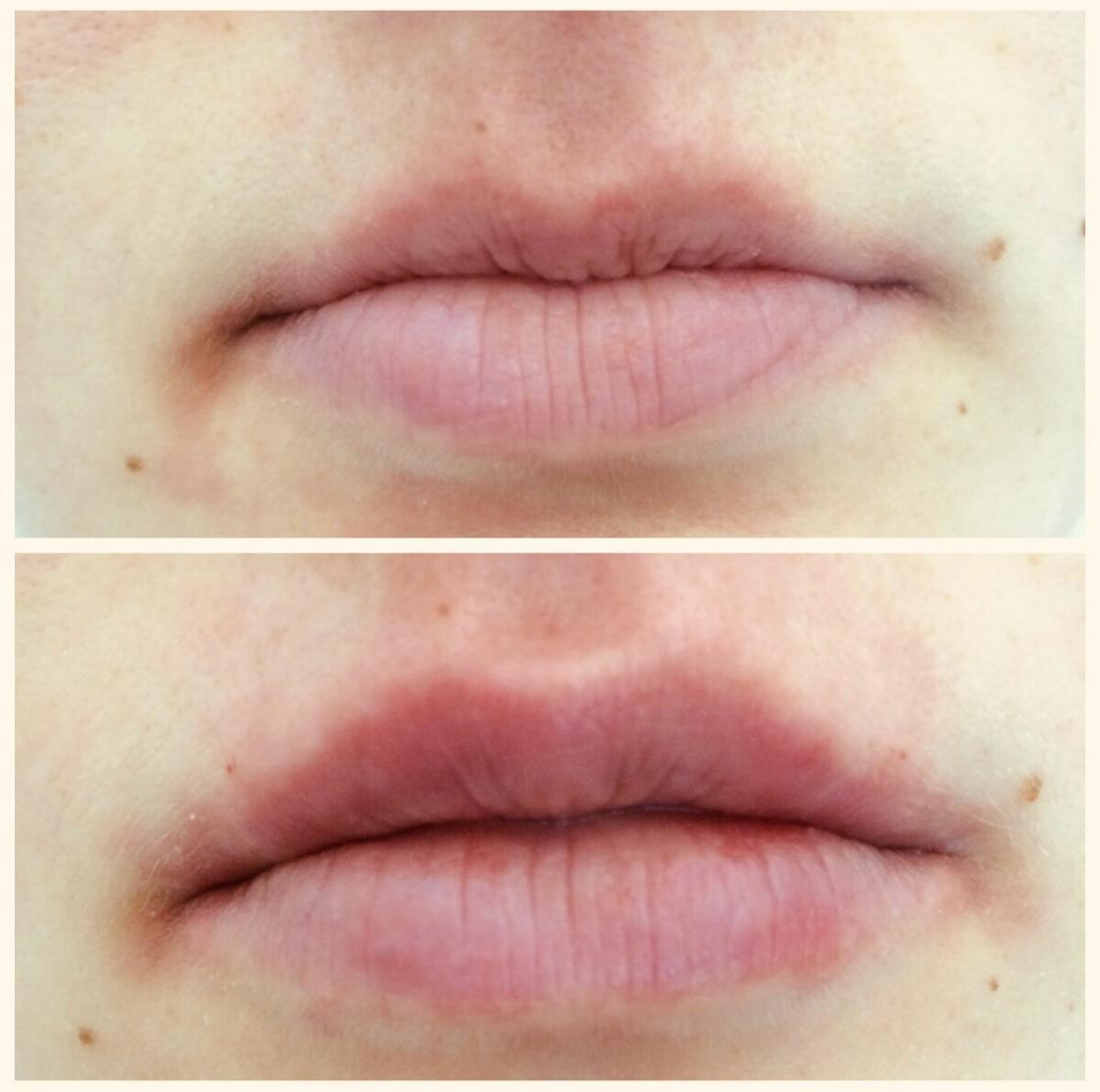 Результаты до и после