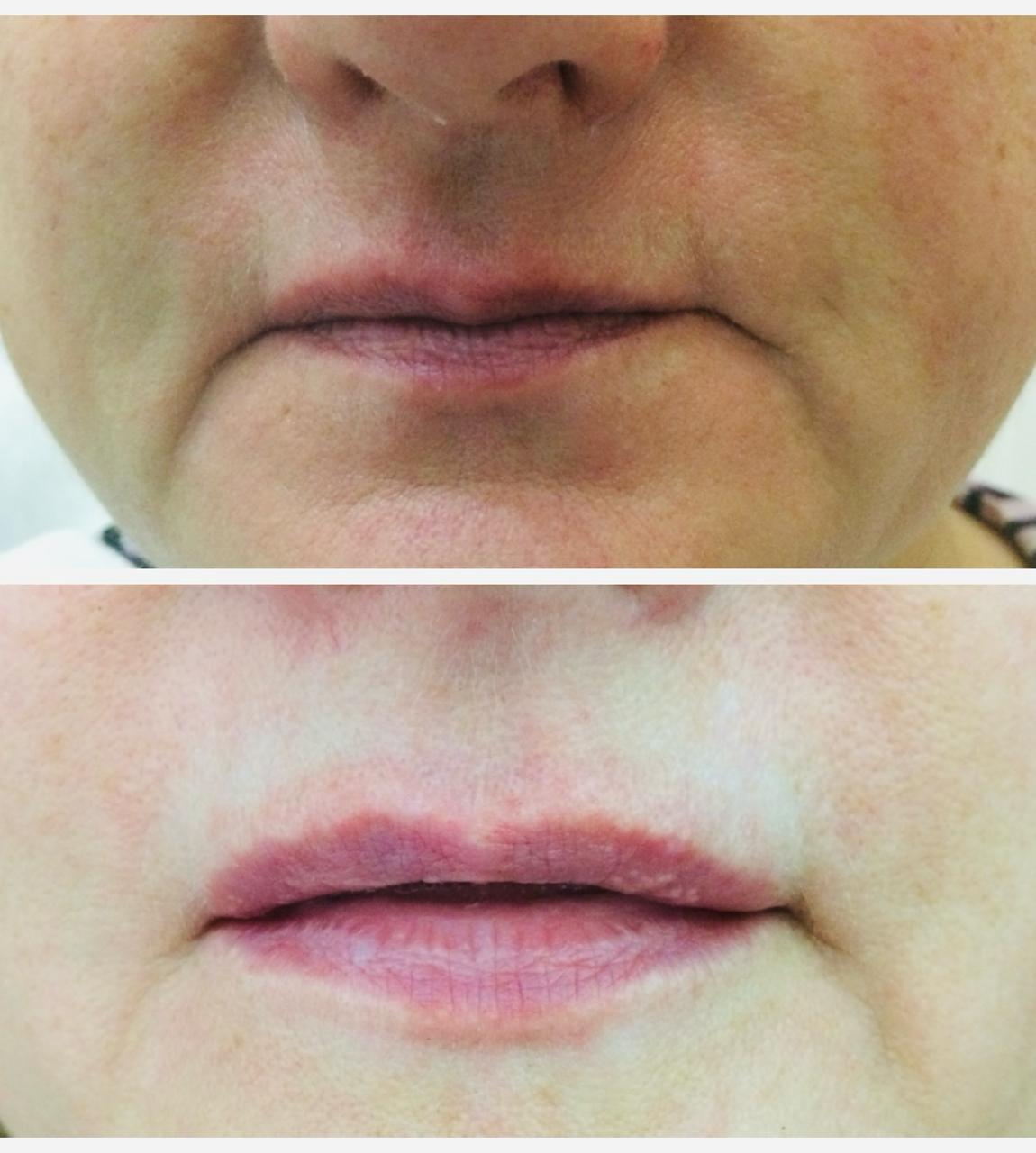 Результаты до и после