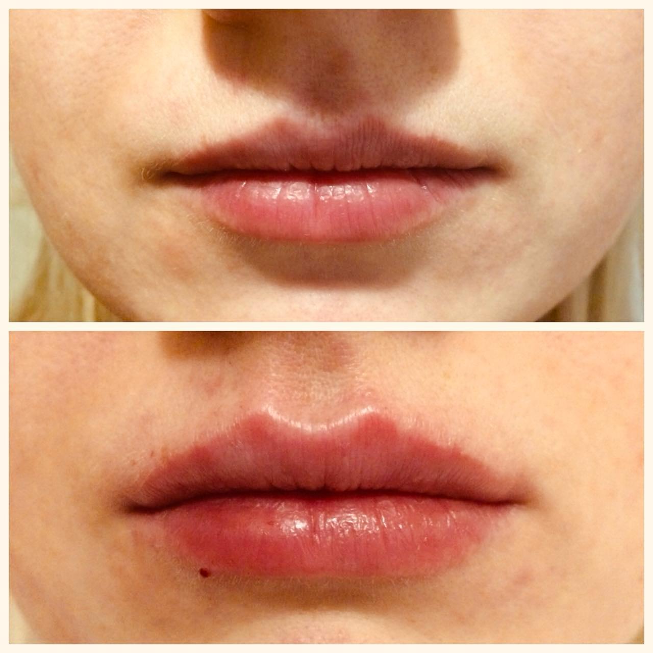 Результаты до и после