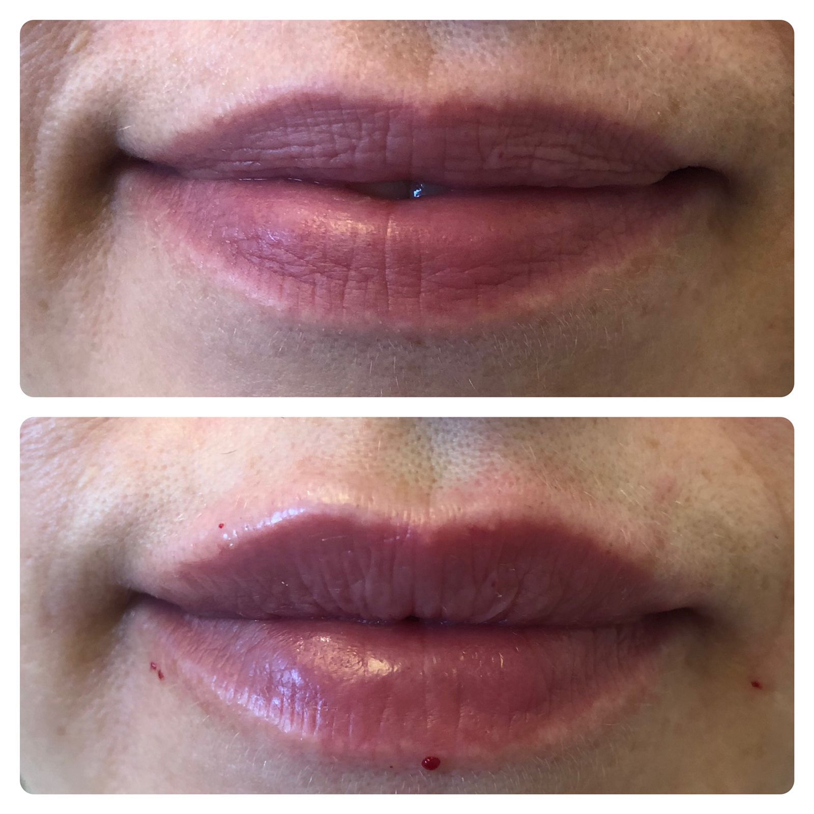 Использование такого-то препарата