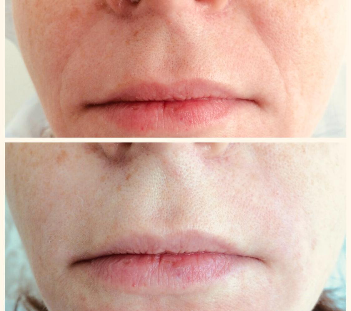 Результаты до и после