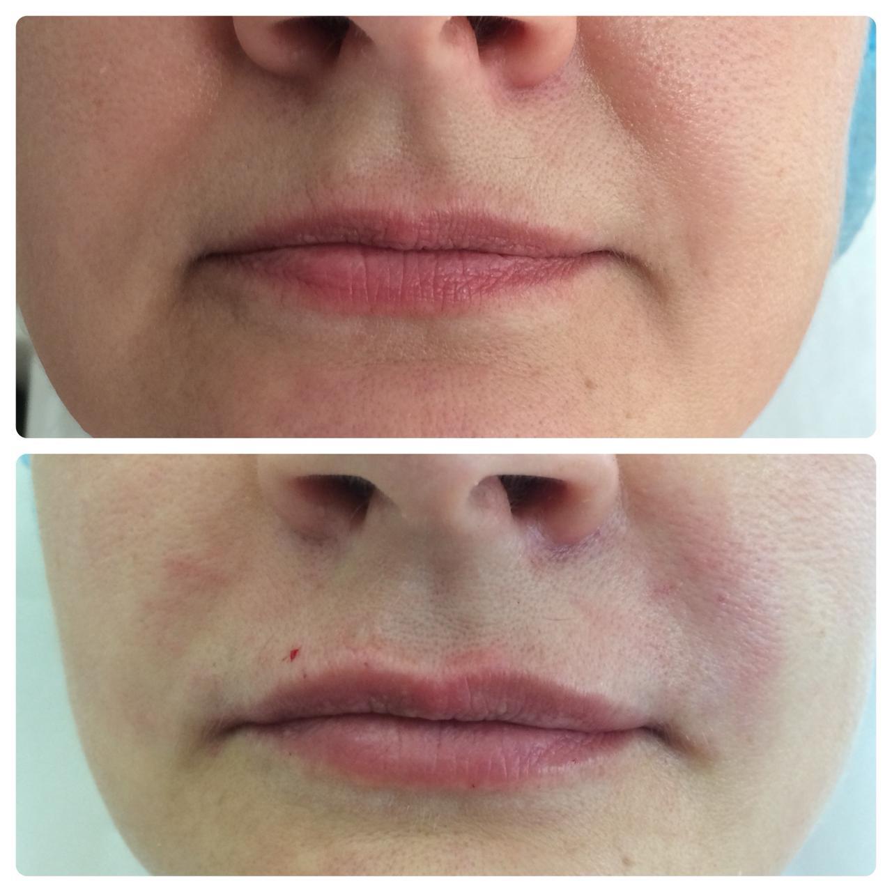 Результаты до и после