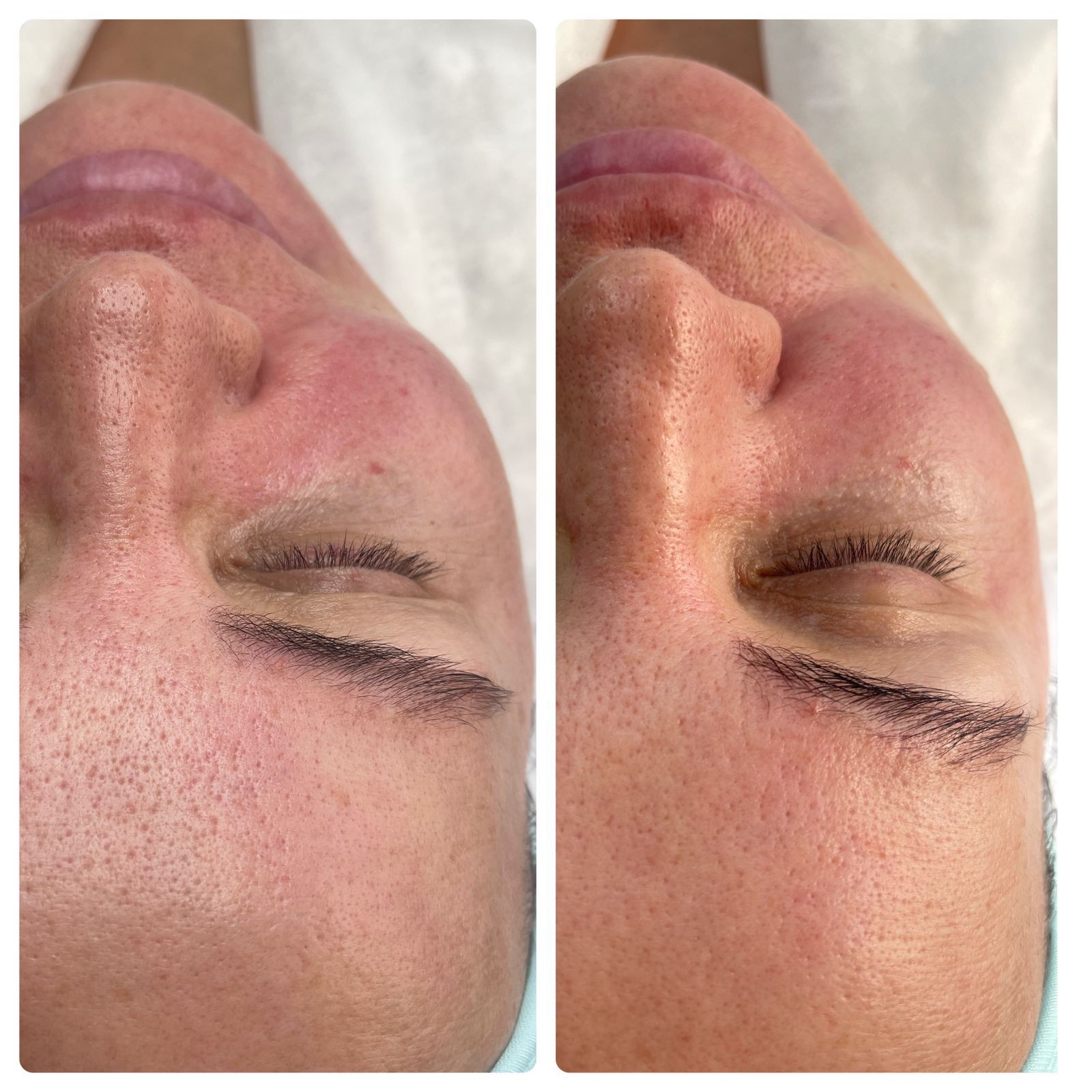 Результаты до и после