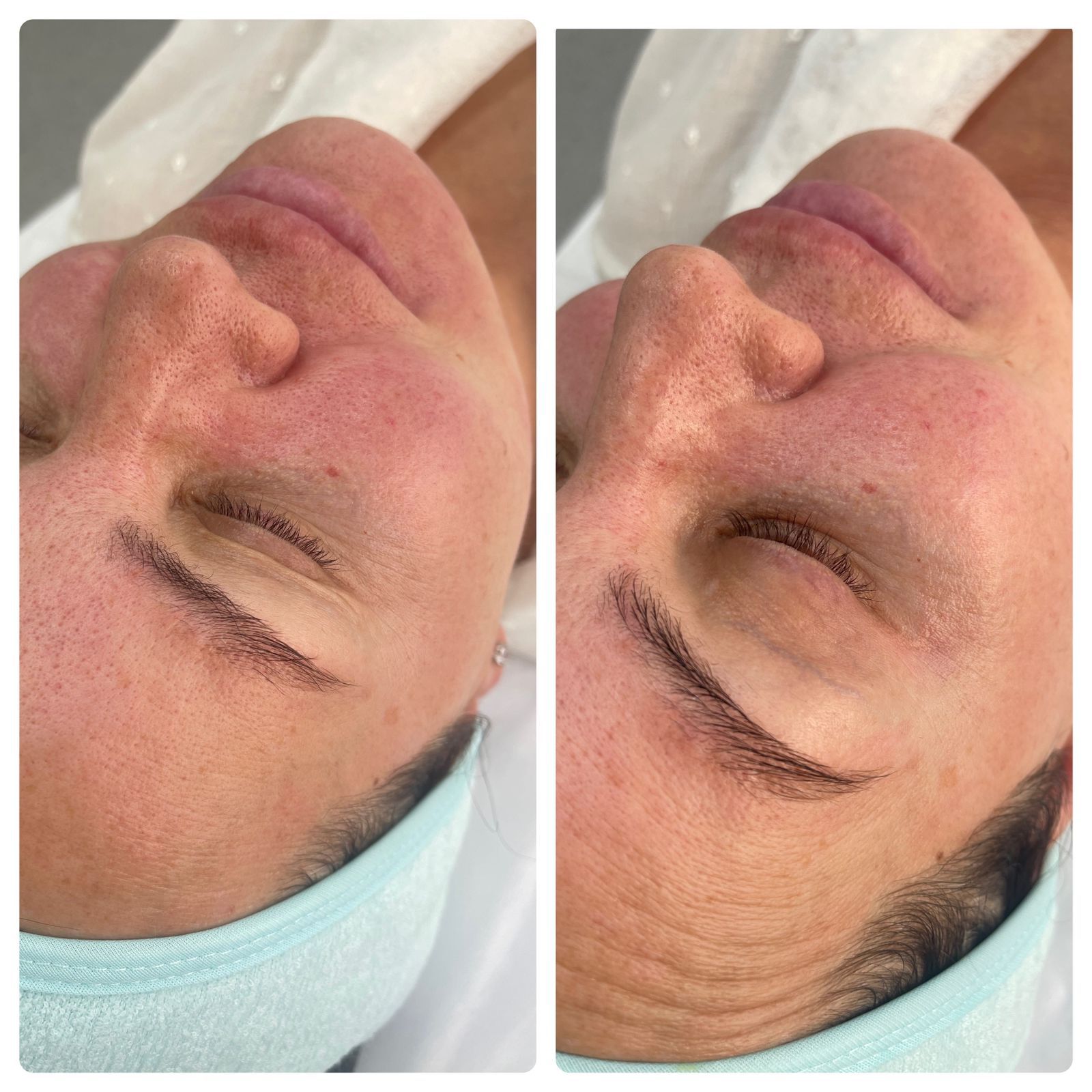 Результаты до и после