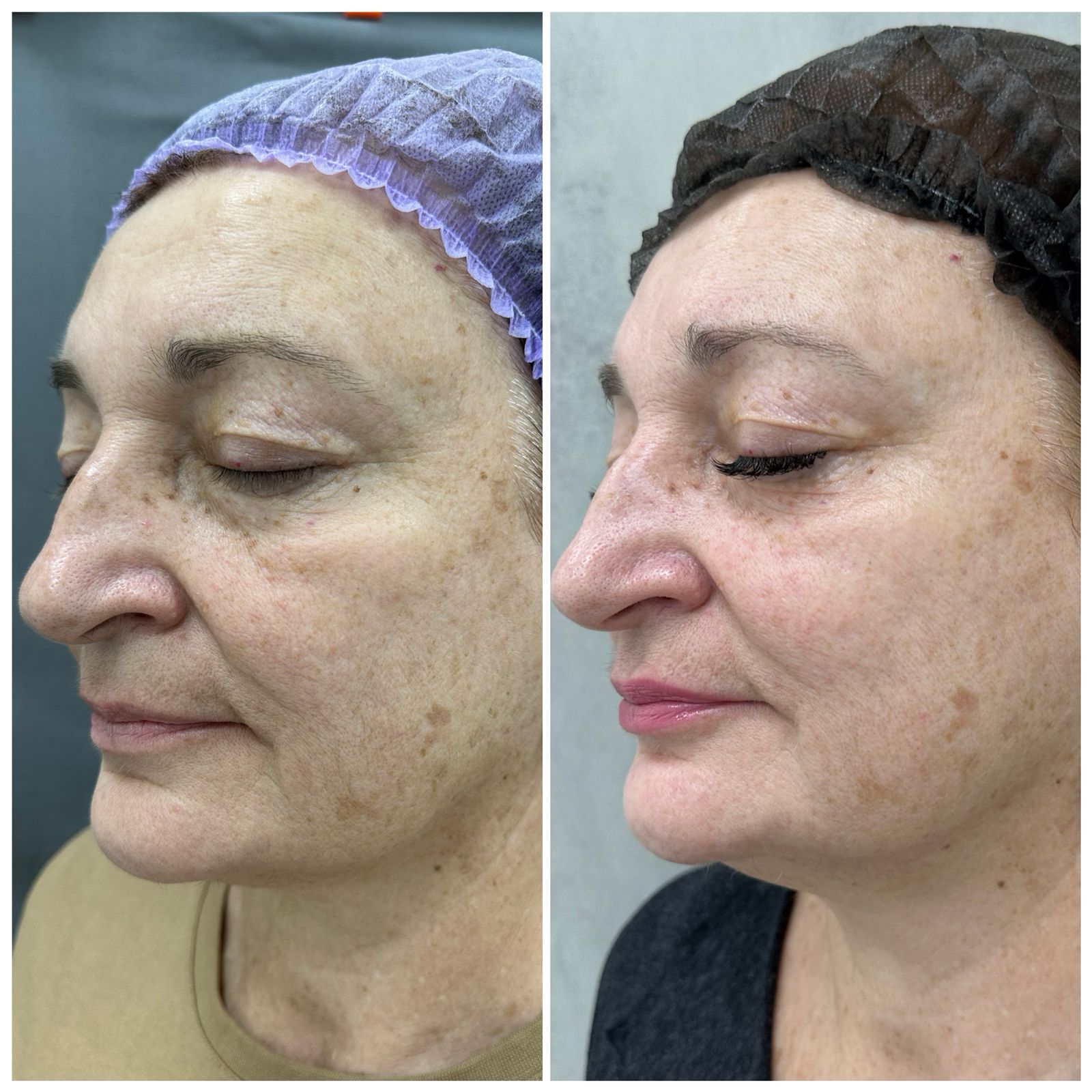 Результаты до и после