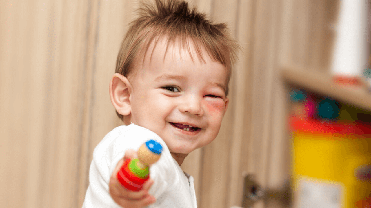 аллергия у ребенка фото лечение