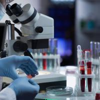 Новый класс биомаркеров болезни Альцгеймера на основе структурных изменений белков плазмы