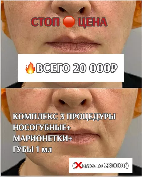 Программа омоложения лица от врача-косметолога — миниатюра 3