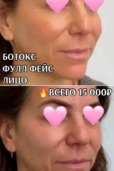 Врач-косметолог в Бирске