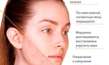 Дизайн инфографики