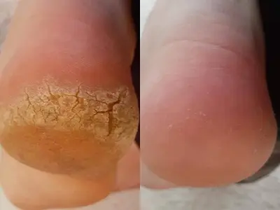 Любовь Шевчук — работа