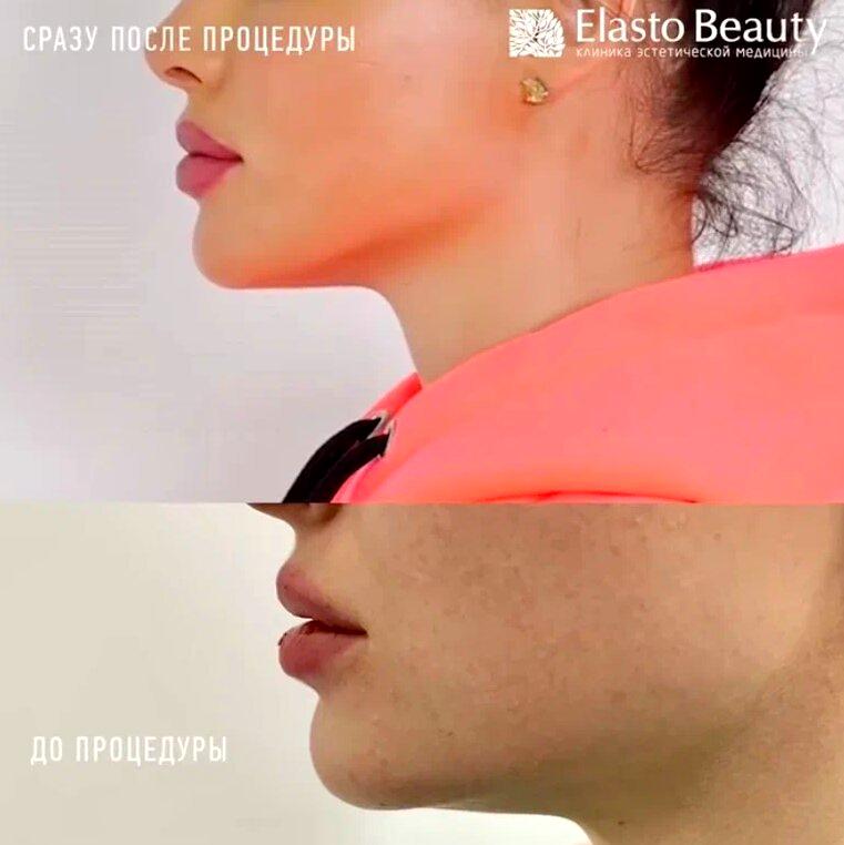 Изображение №20 компании Elasto beauty