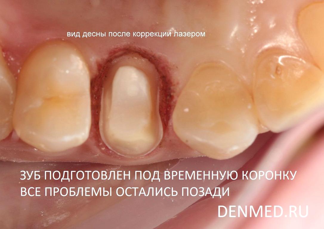 Изображение №4 компании Клиника дентальной медицины на улице Дмитрия Ульянова