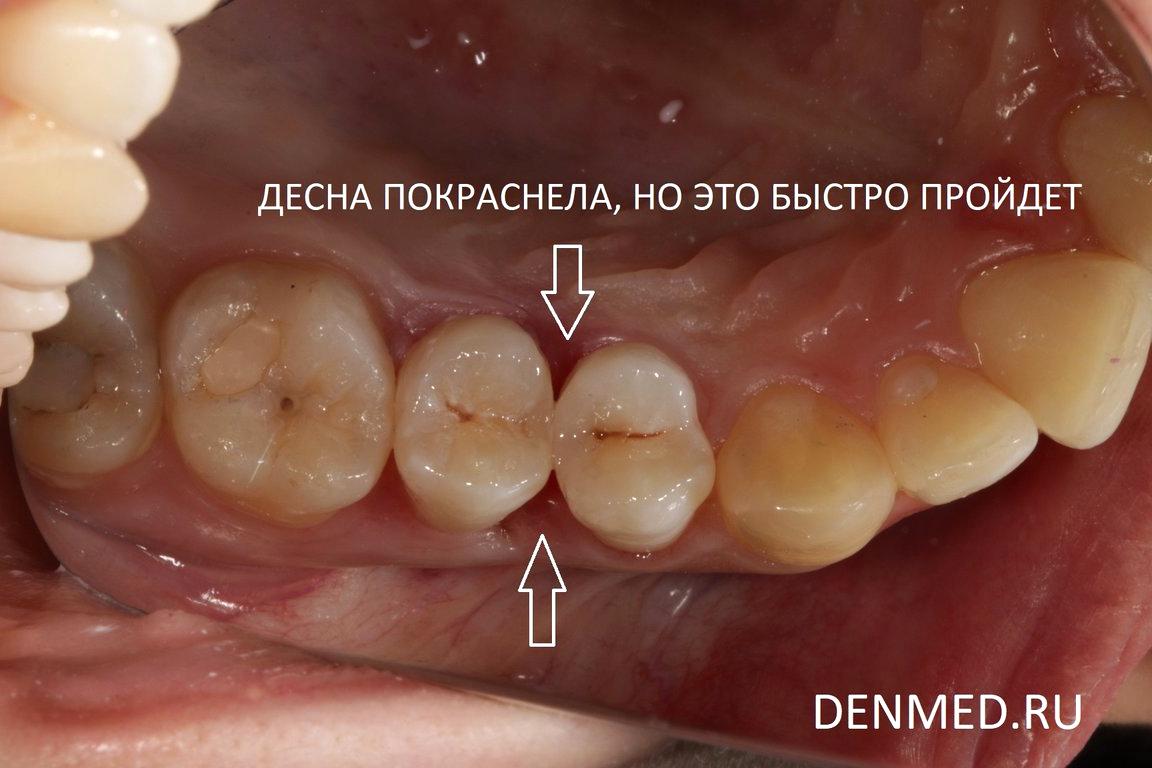 Изображение №11 компании Клиника дентальной медицины на улице Дмитрия Ульянова