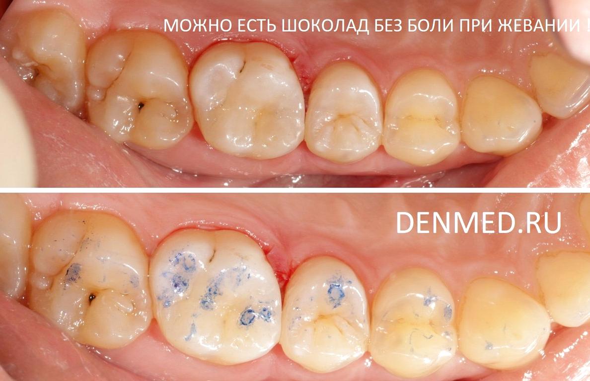 Изображение №14 компании Клиника дентальной медицины на улице Дмитрия Ульянова