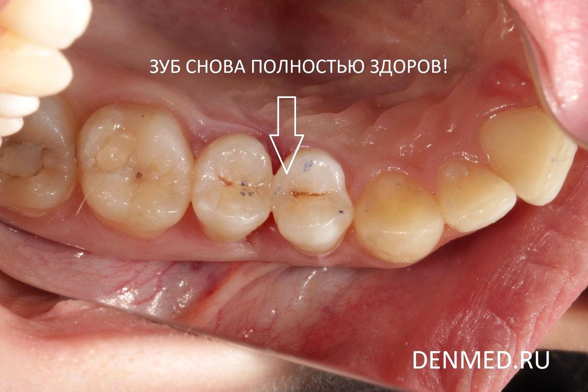 Изображение №9 компании Клиника дентальной медицины на улице Дмитрия Ульянова