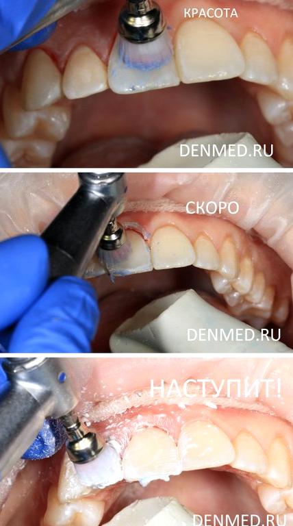 Изображение №2 компании Клиника дентальной медицины на улице Дмитрия Ульянова