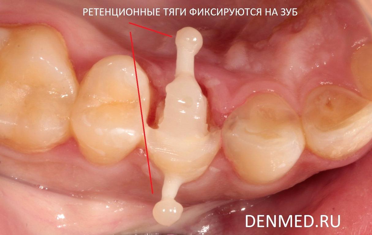 Изображение №16 компании Клиника дентальной медицины на улице Дмитрия Ульянова