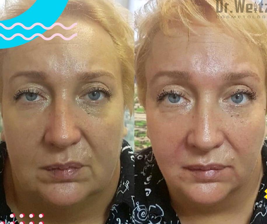 Изображение №5 компании Клиника косметологии DR. WEITZ COSMETOLOGY