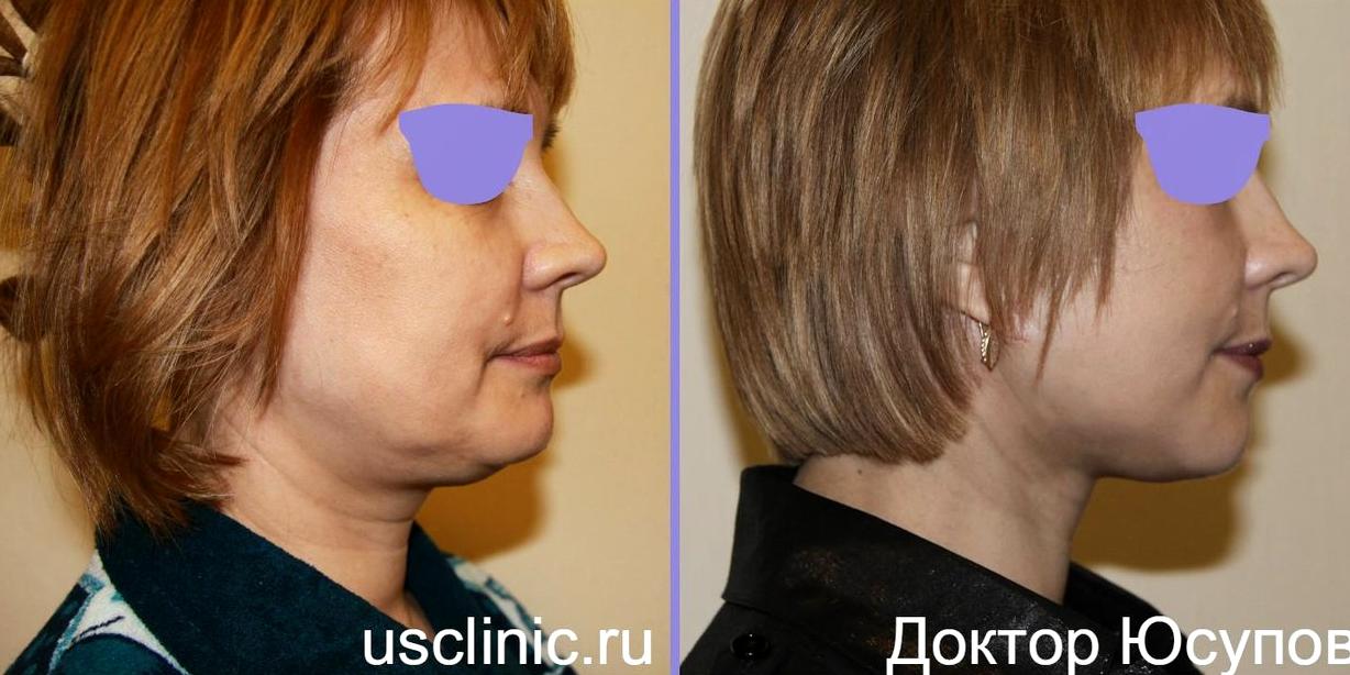 Изображение №1 компании Клиника пластической хирургии US Clinic