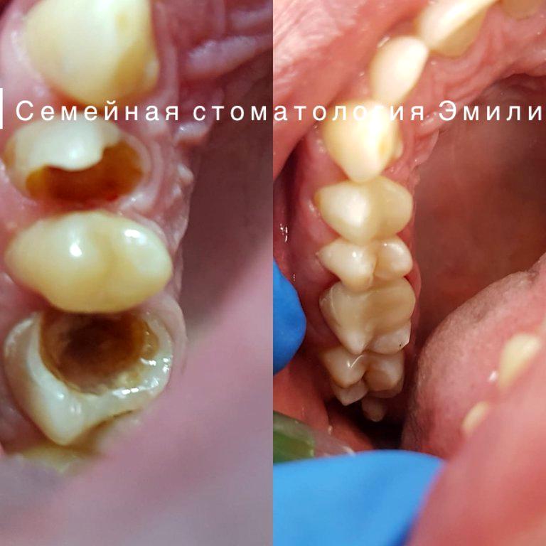 Изображение №19 компании Семейная стоматология Эмили