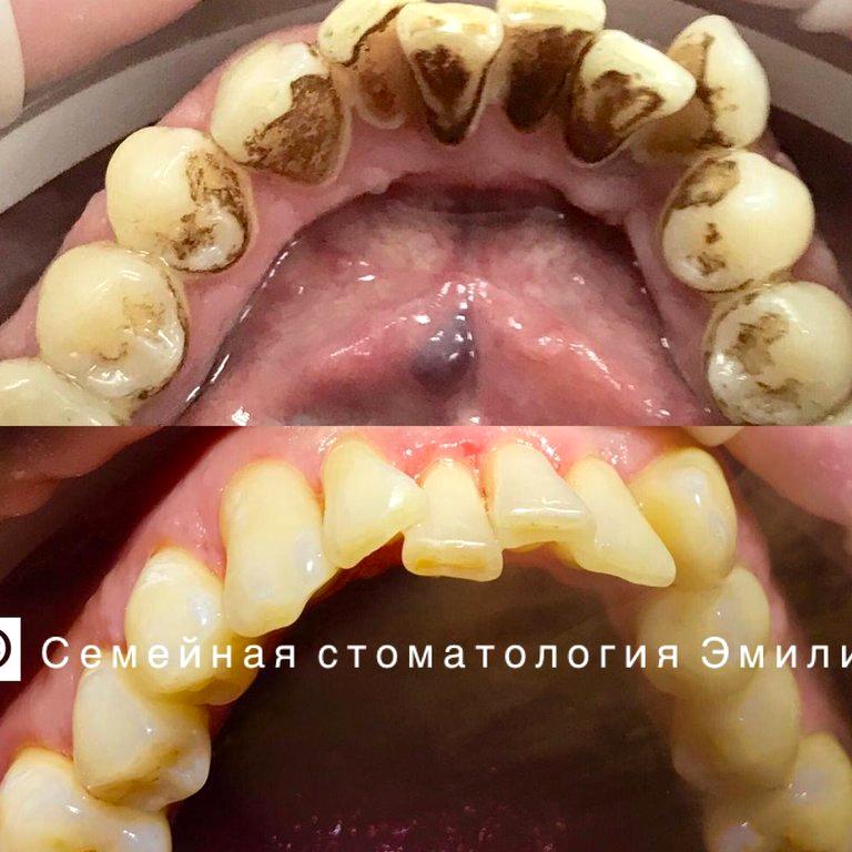 Изображение №14 компании Семейная стоматология Эмили