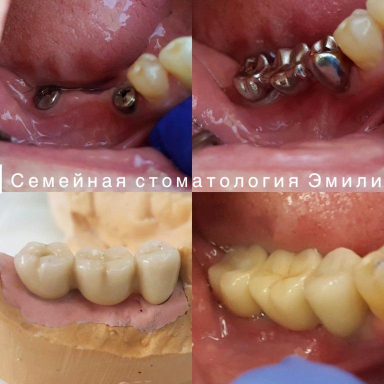 Изображение №13 компании Семейная стоматология Эмили