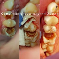 Изображение №2 компании Семейная стоматология Эмили