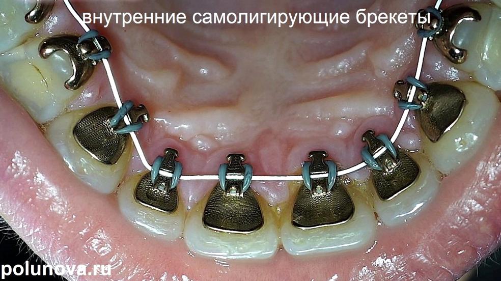 Изображение №7 компании Ортодонтика