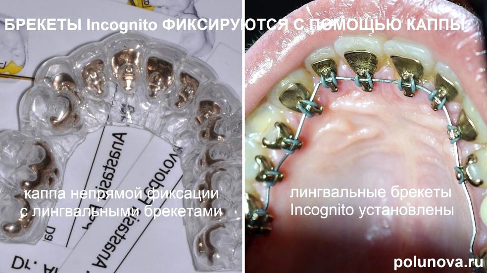 Изображение №11 компании Ортодонтика