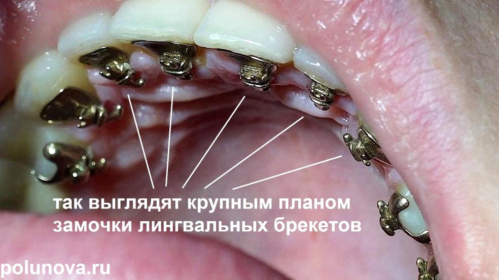 Изображение №20 компании Ортодонтика