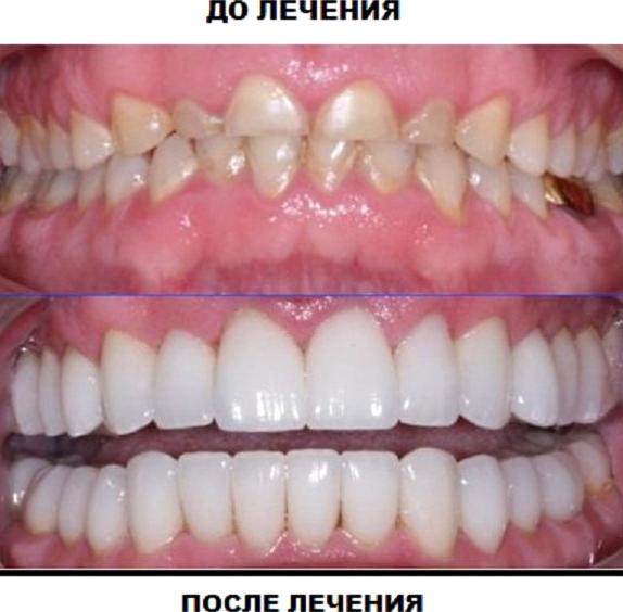 Изображение №4 компании Дентал ньюз плюс