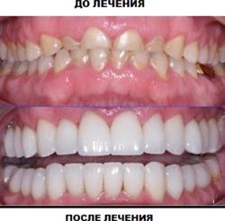 Изображение №2 компании Дентал ньюз плюс