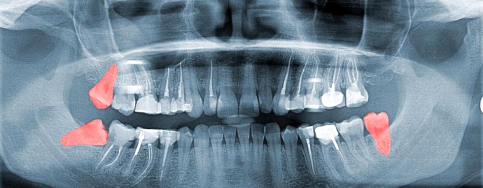 Изображение №19 компании Colibri dental