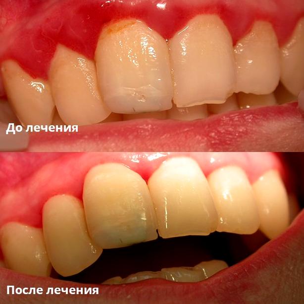 Изображение №11 компании Стоматологическая клиника Европа-м