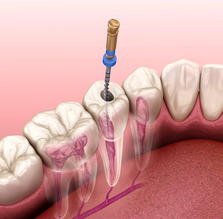 Изображение №5 компании Dental Hi-Tech