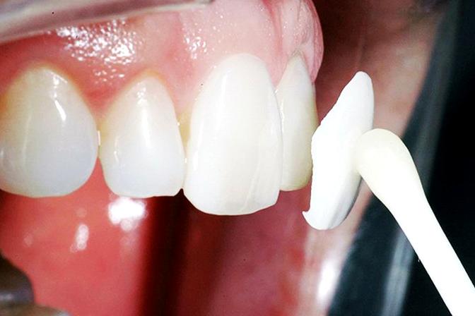 Изображение №17 компании Dentalpro