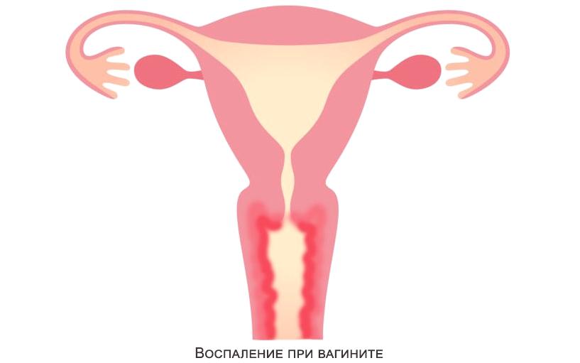 Изображение №2 компании Клиника мужского и женского здоровья на метро Чертановская