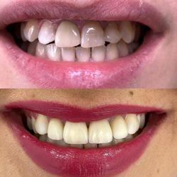 Изображение №1 компании Natura Smile Dental Clinic