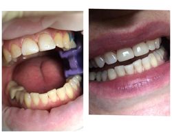 Изображение №3 компании Swiss Tek Dental