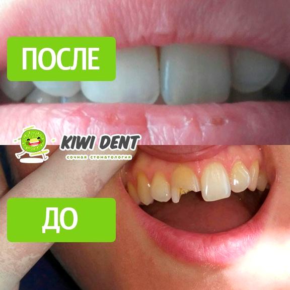 Изображение №15 компании Kiwi Dent