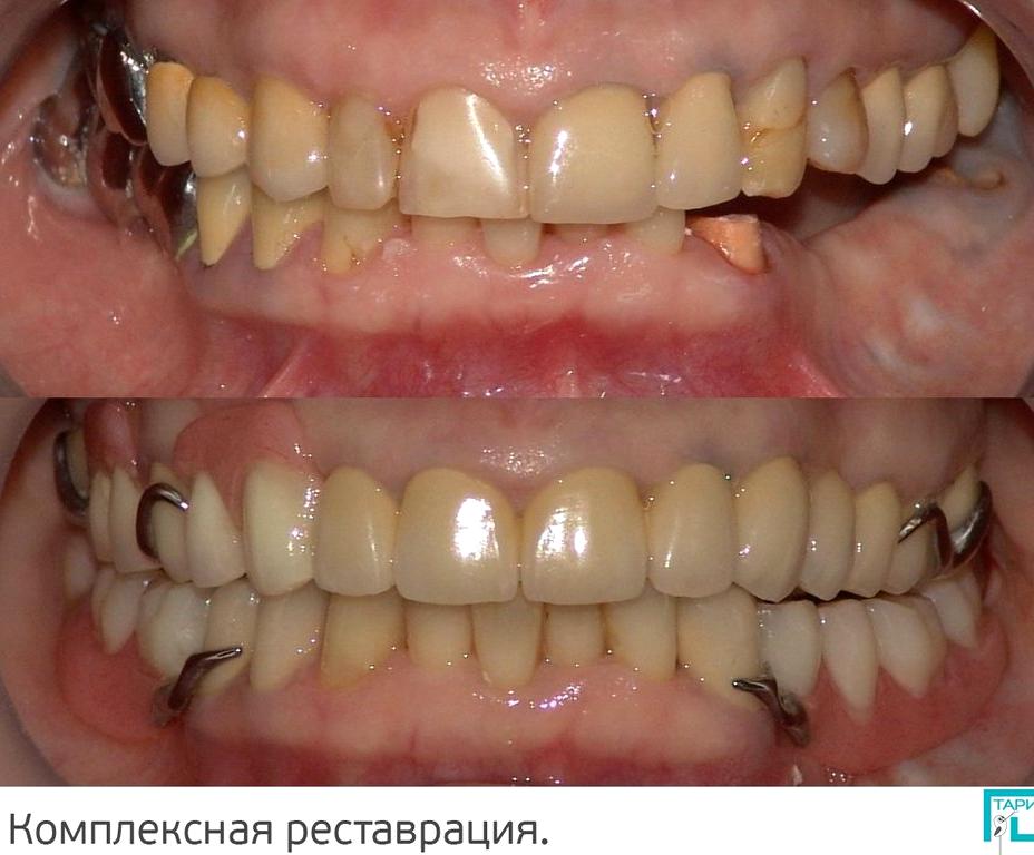 Изображение №6 компании Тари