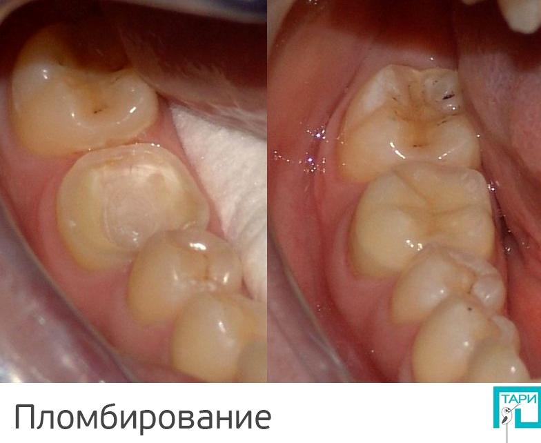 Изображение №18 компании Тари